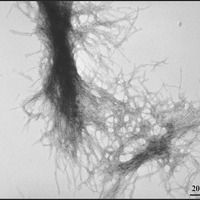 A picture of purified mutant Huntingtin protein aggregates formed in the lab. These clumps of protein are also found in the brain cells of people with HD.