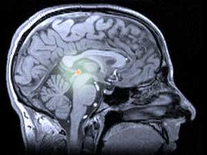 The pineal gland, located deep in the brain, is the main source of the hormone melatonin in humans.  