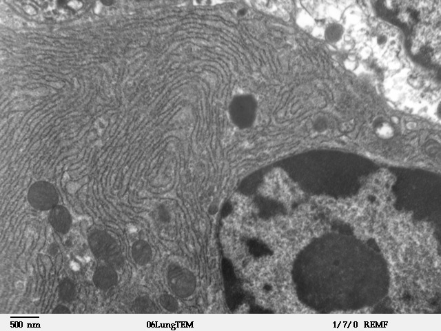 The wavy lines in this image are the "endoplasmic reticulum" of a cell - the storage depots for calcium.  Ryanodine receptors are found on these structures.  