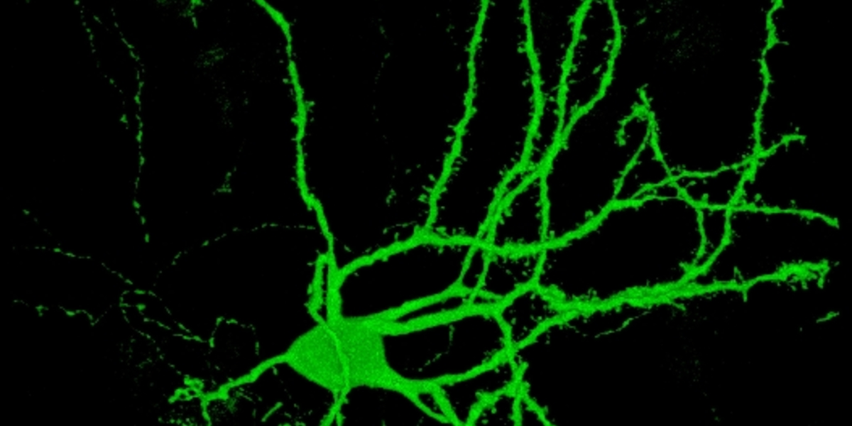 Å omdanne hudceller til hjerneceller: et gjennombrudd innen forskning på Huntingtons sykdom?